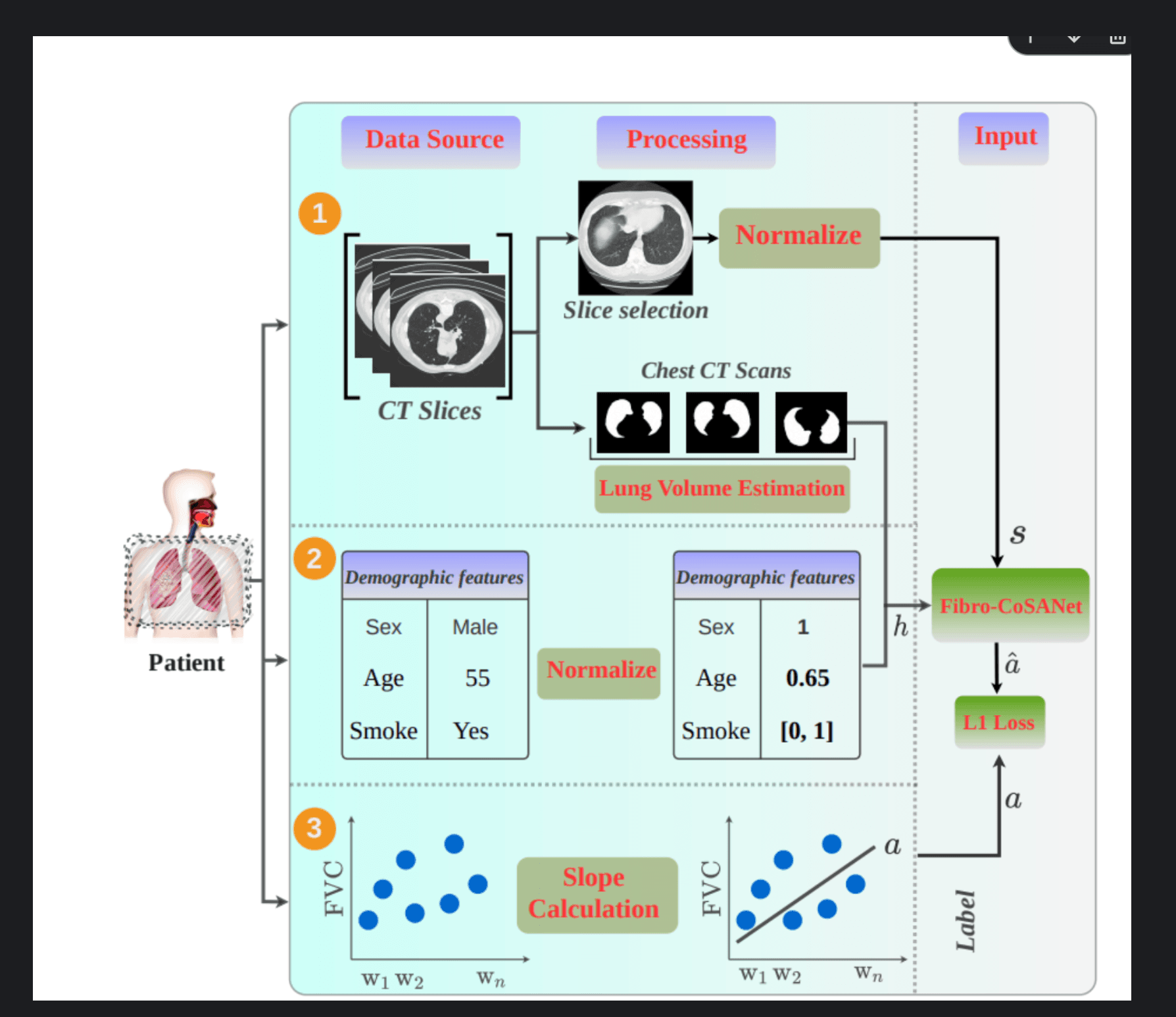 OSIC Pulmonary Fibrosis Progression